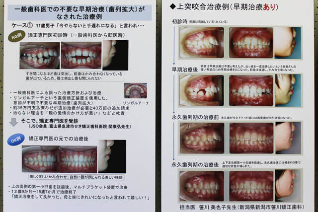 講演写真