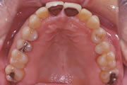 連携歯科医療の治療例