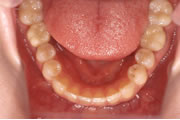 連携歯科医療の治療例