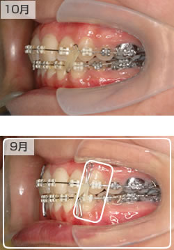 10月と9月の側面の様子